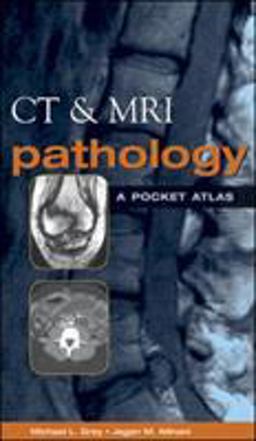 CT and MRI Pathology A Pocket Atlas  9780071380409 Front Cover