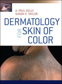 Dermatology for Skin of Color  9780071446716 Front Cover