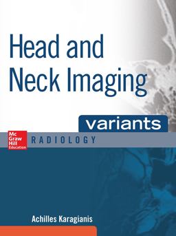Head and Neck Imaging Variants  9780071808675 Front Cover