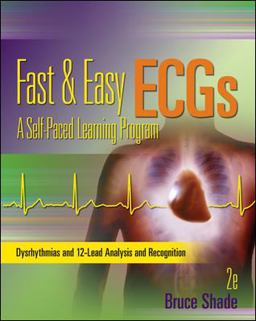 Fast and Easy ECGs: a Self-Paced Learning Program Fast and Easy ECGs: a Self-Paced Learning Program