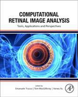 Computational Retinal Image Analysis