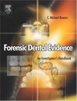 Forensic Dental Evidence An Investigator's Handbook 2nd 9780121210427 Front Cover