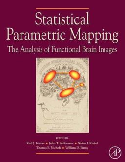 Statistical Parametric Mapping: the Analysis of Functional Brain Images