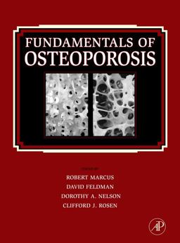 Fundamentals of Osteoporosis 1st 2009 9780123750983 Front Cover