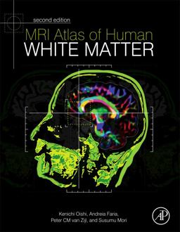 MRI Atlas of Human White Matter 2nd 9780123820815 Front Cover