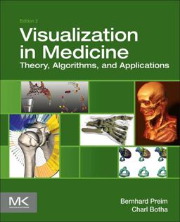 Visual Computing for Medicine