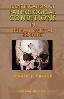 Identification of Pathological Conditions in Human Skeletal Remains 2nd 9780125286282 Front Cover