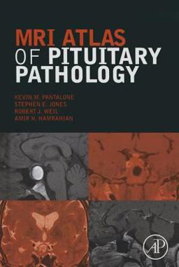 MRI Atlas of Pituitary Pathology  9780128025772 Front Cover