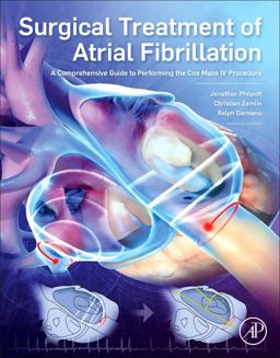 Surgical Treatment of Atrial Fibrillation A Comprehensive Guide to Performing the Cox Maze IV Procedure  9780128046715 Front Cover