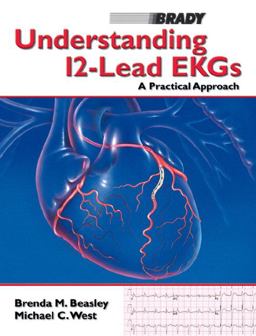 Understanding 12 Lead EKGs A Practical Approach  9780130272812 Front Cover