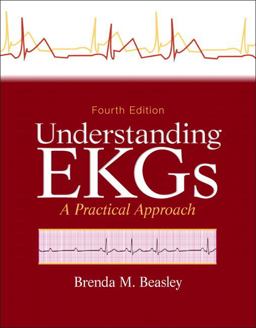 Understanding EKGs A Practical Approach 4th 9780133147728 Front Cover