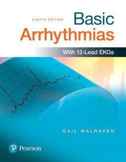 Basic Arrhythmias:  9780134380995 Front Cover