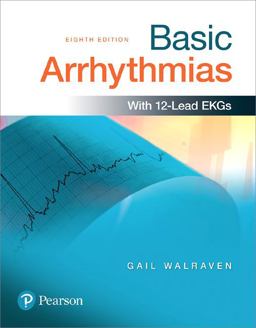 Basic Arrhythmias Plus MyBRADYLab with Pearson EText -- Access Card Package 8th 9780134701073 Front Cover