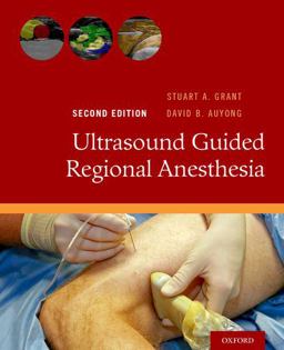 Ultrasound Guided Regional Anesthesia 2nd 9780190231804 Front Cover