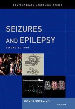 Seizures and Epilepsy 2nd 9780195328547 Front Cover