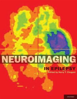 Neuroimaging in Epilepsy  9780195342765 Front Cover