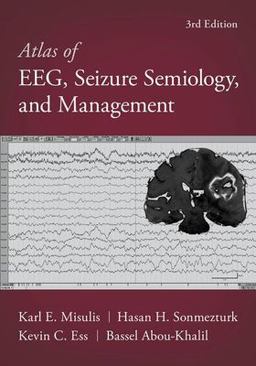 Atlas of EEG, Seizure Semiology, and Management 3rd 9780197543023 Front Cover