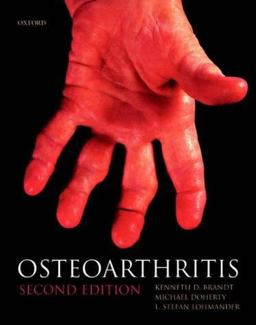 Osteoarthritis 2nd 9780198509677 Front Cover