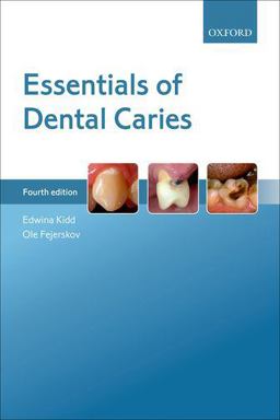 Essentials of Dental Caries 4th 9780198738268 Front Cover