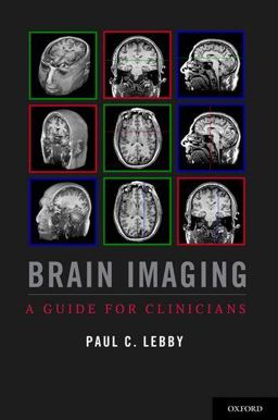 Brain Imaging A Guide for Clinicians  9780199764679 Front Cover