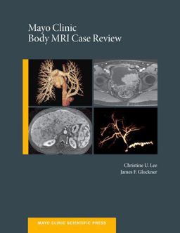 Mayo Clinic Body MRI Case Review  9780199915705 Front Cover