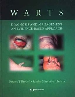 Warts