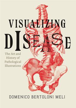 Visualizing Disease The Art and History of Pathological Illustrations  9780226110295 Front Cover