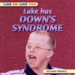 Like Has Down's Syndrome