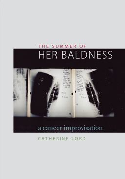 Summer of Her Baldness A Cancer Improvisation  9780292702578 Front Cover