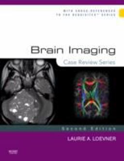 Brain Imaging: Case Review Series 2nd 9780323031790 Front Cover
