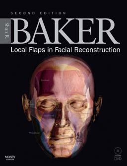 Local Flaps in Facial Reconstruction 2nd 9780323036849 Front Cover