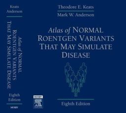 Atlas of Normal Roentgen Variants That May Simulate Disease 8th 9780323043007 Front Cover