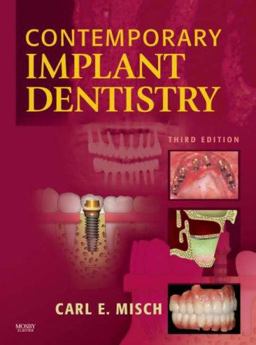 Contemporary Implant Dentistry 3rd 9780323043731 Front Cover