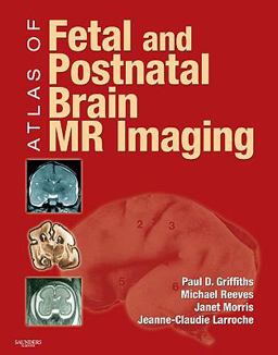 Atlas of Fetal and Postnatal Brain MR