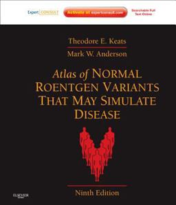 Atlas of Normal Roentgen Variants That May Simulate Disease Expert Consult - Enhanced Online Features and Print 9th 9780323073554 Front Cover