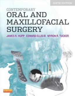 Contemporary Oral and Maxillofacial Surgery 6th 9780323091770 Front Cover