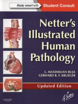 Netter's Illustrated Human Pathology Updated Edition With Student Consult Access  9780323220897 Front Cover