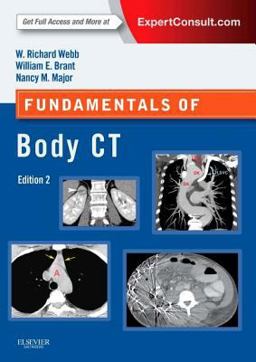 Fundamentals of Body CT 4th 9780323221467 Front Cover