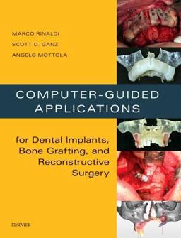 Computer-Guided Applications for Dental Implants, Bone Grafting, and Reconstructive Surgery (adapted Translation)  9780323278034 Front Cover