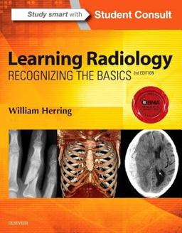 Learning Radiology Recognizing the Basics 3rd 9780323328074 Front Cover