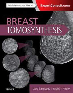 Breast Tomosynthesis  9780323358279 Front Cover