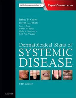 Dermatological Signs of Systemic Disease 5th 9780323358293 Front Cover