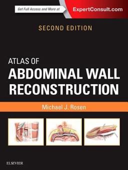 Atlas of Abdominal Wall Reconstruction 2nd 9780323374590 Front Cover