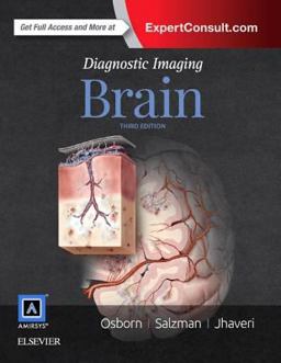 Diagnostic Imaging: Brain 3rd 9780323377546 Front Cover