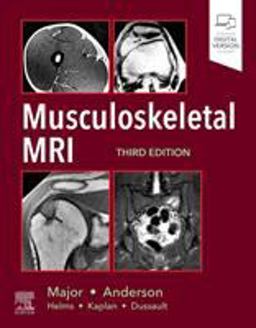 Musculoskeletal MRI 3rd 9780323415606 Front Cover