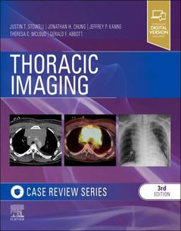 Thoracic Imaging: Case Review 3rd 9780323428798 Front Cover