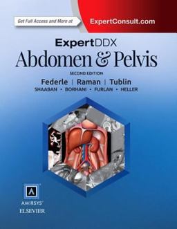 ExpertDDx: Abdomen and Pelvis 2nd 9780323442879 Front Cover