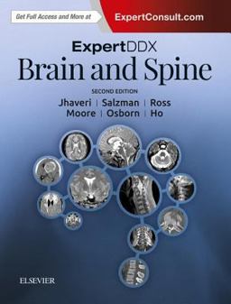 ExpertDDx: Brain and Spine 2nd 9780323443081 Front Cover