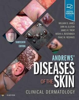 Andrews' Diseases of the Skin Clinical Dermatology 13th 9780323547536 Front Cover