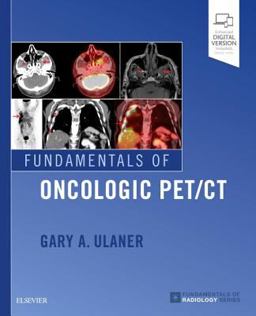 Fundamentals of Oncologic PET/CT  9780323568692 Front Cover